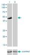Purinergic Receptor P2X 5 antibody, H00005026-M01, Novus Biologicals, Western Blot image 