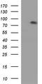 Coagulation Factor XIII B Chain antibody, TA590714, Origene, Western Blot image 