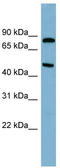 Pantothenate Kinase 4 antibody, TA344906, Origene, Western Blot image 