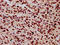 H12 antibody, LS-C676858, Lifespan Biosciences, Immunohistochemistry paraffin image 