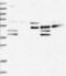Pleckstrin Homology Domain Containing N1 antibody, NBP1-84191, Novus Biologicals, Immunohistochemistry paraffin image 