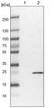 5', 3'-Nucleotidase, Cytosolic antibody, NBP1-84564, Novus Biologicals, Western Blot image 