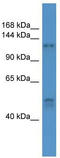 Collagen Type I Alpha 1 Chain antibody, TA342814, Origene, Western Blot image 