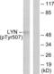 LYN Proto-Oncogene, Src Family Tyrosine Kinase antibody, LS-C199208, Lifespan Biosciences, Western Blot image 