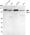 Ubiquitin Like With PHD And Ring Finger Domains 1 antibody, STJ98567, St John