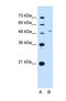 Solute Carrier Family 29 Member 2 antibody, NBP1-69312, Novus Biologicals, Western Blot image 