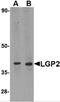 DExH-Box Helicase 58 antibody, 4353, ProSci, Western Blot image 