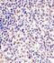 Dihydropyrimidinase Like 5 antibody, M08644-1, Boster Biological Technology, Immunohistochemistry paraffin image 