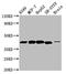 Delta Like Non-Canonical Notch Ligand 1 antibody, CSB-PA006945LA01HU, Cusabio, Western Blot image 