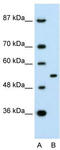 Mint-1 antibody, TA330004, Origene, Western Blot image 