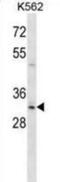 Homeobox B8 antibody, abx028573, Abbexa, Western Blot image 