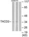 Tumor Associated Calcium Signal Transducer 2 antibody, TA313108, Origene, Western Blot image 