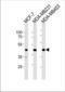 Gamma-sarcoglycan antibody, TA325183, Origene, Western Blot image 