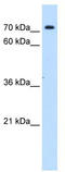 Sodium/myo-inositol cotransporter 2 antibody, TA333568, Origene, Western Blot image 