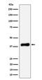 NAD(P) Dependent Steroid Dehydrogenase-Like antibody, M04902-1, Boster Biological Technology, Western Blot image 