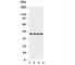 ATF4 antibody, R30614, NSJ Bioreagents, Western Blot image 
