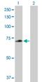 Zinc Finger Protein 567 antibody, H00163081-B01P, Novus Biologicals, Western Blot image 
