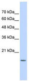 GABA Type A Receptor Associated Protein Like 1 antibody, TA333634, Origene, Western Blot image 