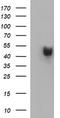 Parvin Beta antibody, TA505679BM, Origene, Western Blot image 