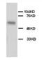 Alkaline Phosphatase, Biomineralization Associated antibody, AP23298PU-N, Origene, Western Blot image 