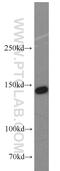 Structural Maintenance Of Chromosomes 1A antibody, 21695-1-AP, Proteintech Group, Western Blot image 