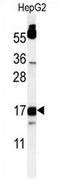 TYRO Protein Tyrosine Kinase Binding Protein antibody, AP54428PU-N, Origene, Western Blot image 