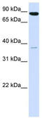 Acyl-CoA Synthetase Long Chain Family Member 3 antibody, TA339415, Origene, Western Blot image 