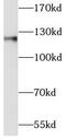 Cadherin 1 antibody, FNab02617, FineTest, Western Blot image 
