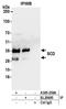 Scd antibody, A305-259A, Bethyl Labs, Immunoprecipitation image 