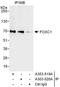 Forkhead Box C1 antibody, A303-519A, Bethyl Labs, Immunoprecipitation image 
