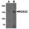 Regulator Of G Protein Signaling 22 antibody, MBS151166, MyBioSource, Western Blot image 