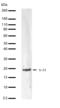 IL-12 antibody, 701235, Invitrogen Antibodies, Western Blot image 