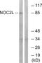NOC2 Like Nucleolar Associated Transcriptional Repressor antibody, GTX87980, GeneTex, Western Blot image 