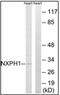 Neurexophilin 1 antibody, AP32310PU-N, Origene, Western Blot image 