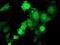 Tropomodulin-1 antibody, MA5-25606, Invitrogen Antibodies, Immunocytochemistry image 
