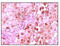 Calcyclin Binding Protein antibody, M04327, Boster Biological Technology, Immunohistochemistry paraffin image 