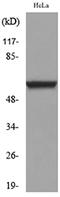 Tumor Protein P63 antibody, LS-C742931, Lifespan Biosciences, Western Blot image 
