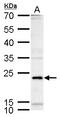 Inducible T Cell Costimulator antibody, GTX129570, GeneTex, Western Blot image 