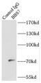 Bardet-Biedl Syndrome 7 antibody, FNab00823, FineTest, Immunoprecipitation image 