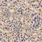 Histone Cluster 3 H3 antibody, A2355, ABclonal Technology, Immunohistochemistry paraffin image 