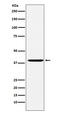 CAPG antibody, M04512, Boster Biological Technology, Western Blot image 