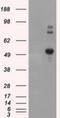 SIL1 Nucleotide Exchange Factor antibody, NBP2-02377, Novus Biologicals, Western Blot image 