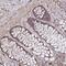 Zinc Finger Protein 805 antibody, PA5-63625, Invitrogen Antibodies, Immunohistochemistry paraffin image 