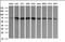 Endoglin antibody, orb179017, Biorbyt, Western Blot image 