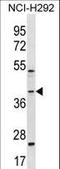 GIPC PDZ Domain Containing Family Member 2 antibody, LS-B15671, Lifespan Biosciences, Western Blot image 