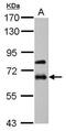 Matrix Metallopeptidase 19 antibody, PA5-34748, Invitrogen Antibodies, Western Blot image 