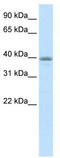 Neuronal Differentiation 6 antibody, TA330529, Origene, Western Blot image 