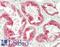Sirtuin 3 antibody, LS-B13905, Lifespan Biosciences, Immunohistochemistry paraffin image 