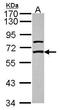 Gamma-Aminobutyric Acid Type A Receptor Epsilon Subunit antibody, GTX115026, GeneTex, Western Blot image 