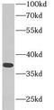 Malate dehydrogenase, cytoplasmic antibody, FNab05073, FineTest, Western Blot image 
